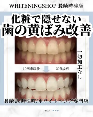 ホワイトニングショップ時津店所属・ホワイトニング ショップ長崎時津店のその他イメージ