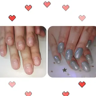 ミディアム ネイル フィルイン、長さ出し 深爪矯正のネイルデザイン