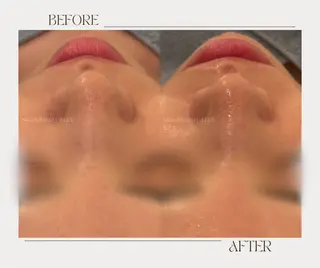 艶肌ワックス ALLY.のエステ・リラクイメージ