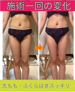 ショート カラー パーマ ヘアアレンジ メンズ キッズ ネイル マツエク・マツパ ‍痩身＆ボディ 結果出し🌟丹野のエステ・リラクイメージ