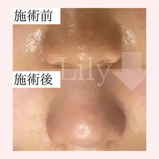 トータルビューティー サロンLilyのエステ・リラクイメージ