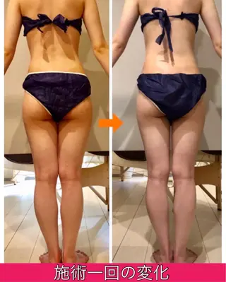 ロング カラー パーマ ヘアアレンジ メンズ キッズ ネイル マツエク・マツパ ‍痩身＆ボディ 結果出し🌟丹野のエステ・リラクイメージ