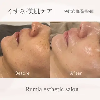 Rumia esthetic salon所属・芯美 -shinbi-のエステ・リラクイメージ