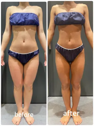 👑Linolaby RAYVIS👑⭐️のエステ・リラクイメージ