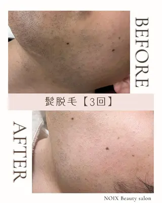 メンズ NOIXbeauty salonの眉毛・アイブロウイメージ