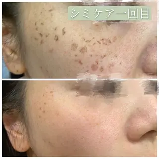 🅖🅤🅩🅔🅛 salonのエステ・リラクイメージ