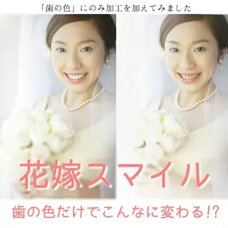 カラー DIA WHITE 奥田のその他イメージ