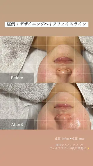 ALIA Scintiller  アリアサンティエ所属・齋藤 祐里耶のエステ・リラクイメージ