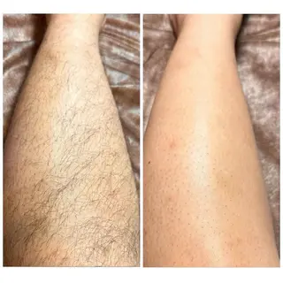 メンズ JOLF salon originalのエステ・リラクイメージ