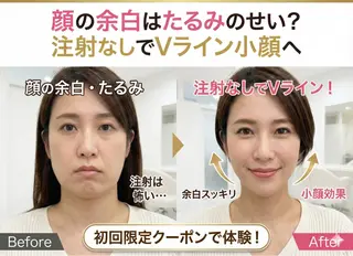 【歴13年】劇的小顔 D rマジックタッチのエステ・リラクイメージ