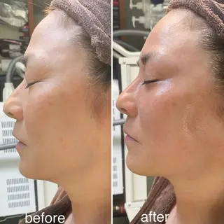 Ring -femのエステ・リラクイメージ