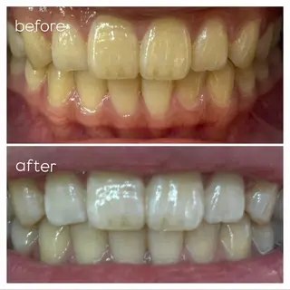 エクシア津駅前店所属・セルフホワイトニング エクシア津駅前店のその他イメージ