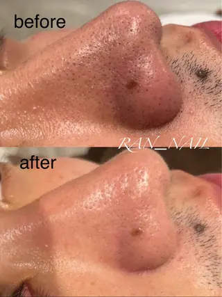 スカルプ💅🏻 /ホワイトニングのネイルデザイン