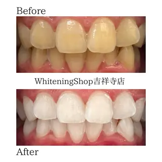 ホワイトニング ショップ吉祥寺店のエステ・リラクイメージ