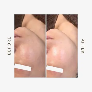 1st｜フェイシャル エステ専門店のエステ・リラクイメージ