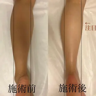 WOM SALON所属・MIKU【美容整形ダ ウンタイムケア銀座】のエステ・リラクイメージ