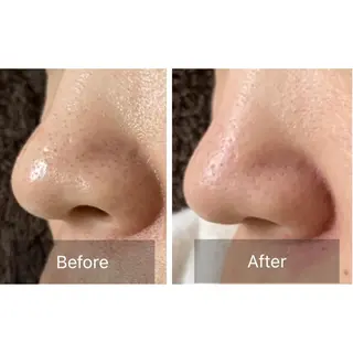 Laki  ドライヘッドスパ&ライトエステ所属・Laki  毛穴ケア とヘッドスパのサロンのエステ・リラクイメージ