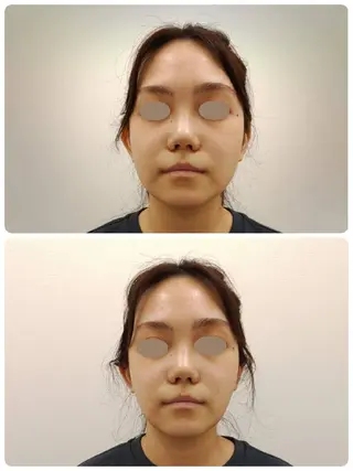 CORAL湘南平塚店所属・【小顔・美容専門】 🐠リカのエステ・リラクイメージ