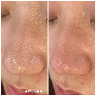 💚THE BALM 金子💚✨のエステ・リラクイメージ