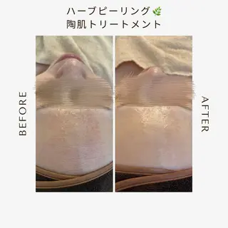 private beauty salon Lilby所属・リルビー 肌育・肌質改善サロンのその他イメージ