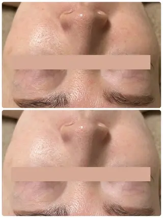 Beauty salon Wish所属・脱毛🌈肌質改善🌈 Wishのエステ・リラクイメージ