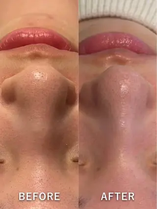 💎美容革命ラボ💎 大名店のエステ・リラクイメージ