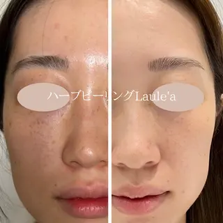 美腸サロン🌺 腸もみ/小顔/リンパのエステ・リラクイメージ