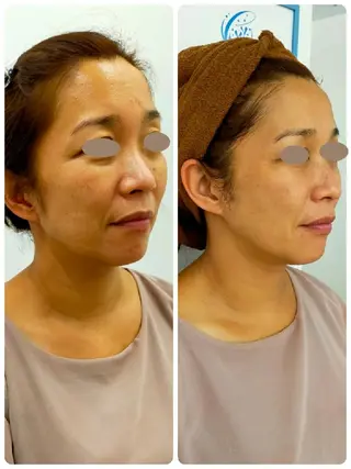 CORAL湘南平塚店所属・【小顔・美容専門】 🐠リカのエステ・リラクイメージ