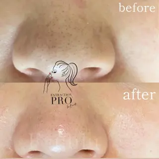 毛穴専門サロン　フルール所属・フルールFululu 自由が丘のエステ・リラクイメージ