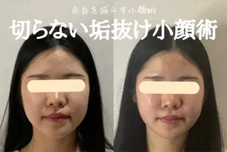 最速小顔・肌質管理 espoirマキのエステ・リラクイメージ