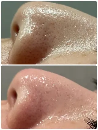 エステ／ネイル/脱毛 R.Msalonのネイルデザイン