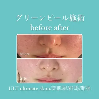 ULT ultimateskin所属・ULT ウルトのエステ・リラクイメージ