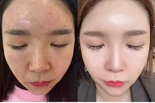 小顔/たるみ/黒ずみ除去専門サロン/SONA 大和西大寺店所属・【小顔専門看護師 サロンSONA】のエステ・リラクイメージ