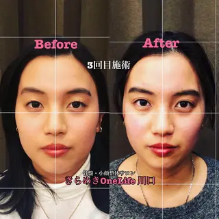 きらめきワンライフ Yumaのエステ・リラクイメージ