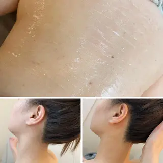 うなじ脱毛/美肌脱毛 LABELのエステ・リラクイメージ