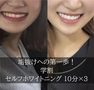 ホワイトニング専門店 LCS 銀座店 峰岡のその他イメージ