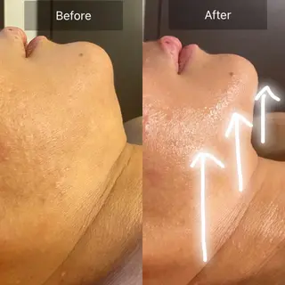 Mandarin Orange所属・毛穴から始める肌メン テマンダリンオレンジのエステ・リラクイメージ