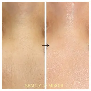 ビューティー ミロワールのエステ・リラクイメージ