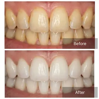 セルフホワイトニング サクッとホワイト   立川店所属・サクッとホワイト 立川店のその他イメージ