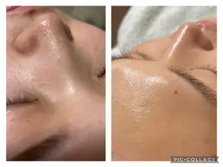 SHIKI モリンガ蒸し/水光肌のエステ・リラクイメージ