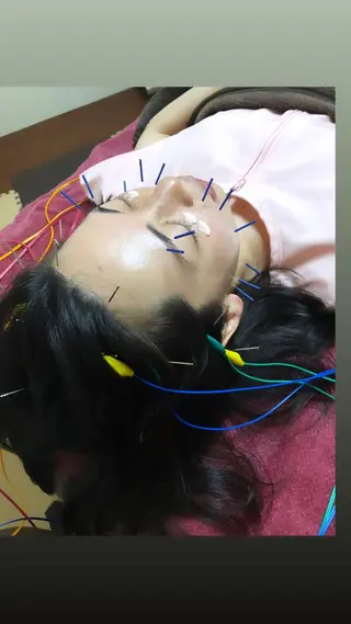 美容鍼灸女性専用 りんご鍼灸治療院のエステ・リラクイメージ