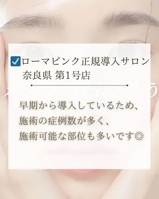 小顔/たるみ/黒ずみ除去専門サロン/SONA 大和西大寺店所属・【小顔専門看護師 サロンSONA】のエステ・リラクイメージ