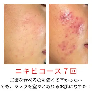 ベラージュ【美背中・ 美尻・フェイシャル】のエステ・リラクイメージ