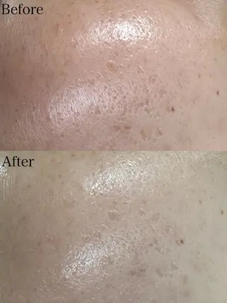 beautysalon LIMOA所属・松本 愛絵理のエステ・リラクイメージ