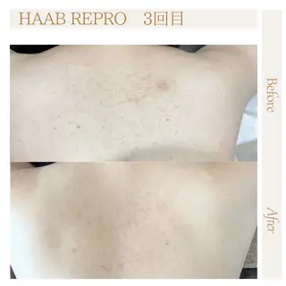 肌管理サロン neoriiのその他イメージ