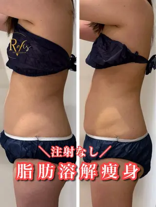 beautysalon RAVIS所属・東大阪/韓国肌管理/ 痩身バスト専門店のエステ・リラクイメージ