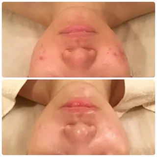 国際認定エステサロン ホワイトカメリアのエステ・リラクイメージ