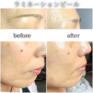 cherir アミのエステ・リラクイメージ