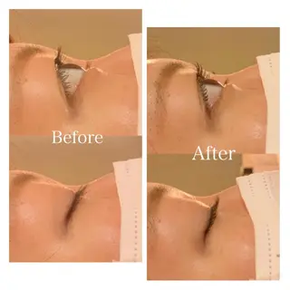 マツエク・マツパ 西岡 美香子のネイルデザイン