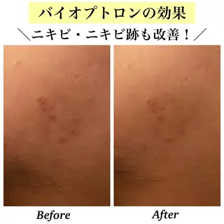 Bellesthe （ベルエステ）のエステ・リラクイメージ